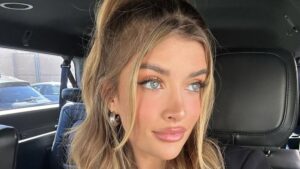 Sami Sheen Lists All of the Cosmetic Surgery Procedures She’s Had Done