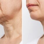 This Esthetician-Approved Cream Helps Women 40+ Firm Crepey Skin — No Office Visit Needed