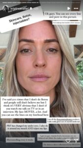 Kristin Cavallari Denies She’s Ever Had Botox in Candid Post