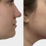 A More Defined Jawline and Tighter Neck Are Possible With This Firming Serum